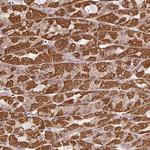 CLASP1 Antibody in Immunohistochemistry (Paraffin) (IHC (P))