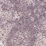 LDLRAD4 Polyclonal Antibody