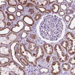 GDPD5 Polyclonal Antibody