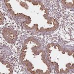 TOCA-1 Antibody in Immunohistochemistry (Paraffin) (IHC (P))