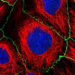 SAMD4A Polyclonal Antibody