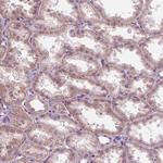 SAMD4A Antibody in Immunohistochemistry (Paraffin) (IHC (P))