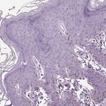 SAMD4A Antibody in Immunohistochemistry (Paraffin) (IHC (P))