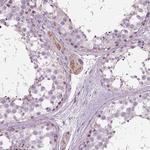 SAMD4A Antibody in Immunohistochemistry (Paraffin) (IHC (P))