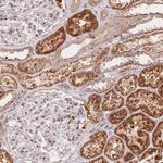 OCC1 Antibody in Immunohistochemistry (Paraffin) (IHC (P))