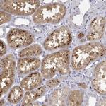 GGACT Antibody in Immunohistochemistry (Paraffin) (IHC (P))