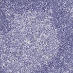 GGACT Antibody in Immunohistochemistry (IHC)
