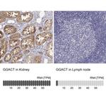 GGACT Antibody