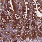 RPL37A Antibody in Immunohistochemistry (Paraffin) (IHC (P))