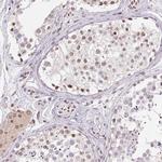 SMIM12 Antibody in Immunohistochemistry (IHC)