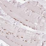 SMIM12 Antibody in Immunohistochemistry (IHC)