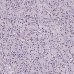 SMIM12 Antibody in Immunohistochemistry (IHC)