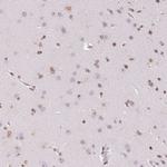 SMIM12 Antibody in Immunohistochemistry (IHC)