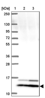 SMIM12 Antibody in Western Blot (WB)