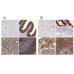 EML4 Polyclonal Antibody
