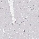 EML4 Antibody in Immunohistochemistry (IHC)