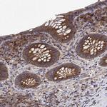 EML4 Antibody in Immunohistochemistry (IHC)