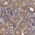 EML4 Antibody in Immunohistochemistry (IHC)