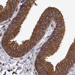 EML4 Antibody in Immunohistochemistry (IHC)