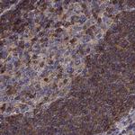 EML4 Antibody in Immunohistochemistry (IHC)