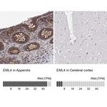 EML4 Antibody