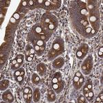 EML4 Antibody in Immunohistochemistry (IHC)