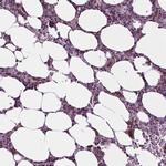 DENND4A Antibody in Immunohistochemistry (Paraffin) (IHC (P))