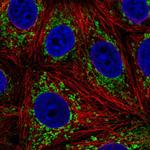 L2HGDH Polyclonal Antibody