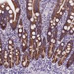 L2HGDH Antibody in Immunohistochemistry (Paraffin) (IHC (P))