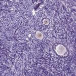 C18orf21 Antibody in Immunohistochemistry (Paraffin) (IHC (P))