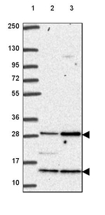 C18orf21 Antibody in Western Blot (WB)