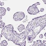 C20orf85 Antibody in Immunohistochemistry (IHC)