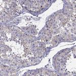 TEX22 Polyclonal Antibody