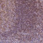 MKRN2OS Polyclonal Antibody