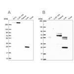 QDPR Antibody in Western Blot (WB)