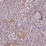 TOPORS Antibody in Immunohistochemistry (IHC)