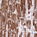 LRR1 Polyclonal Antibody