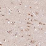 SMIM13 Antibody in Immunohistochemistry (Paraffin) (IHC (P))