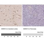 SMIM13 Antibody in Immunohistochemistry (IHC)