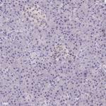 SMIM13 Antibody in Immunohistochemistry (IHC)