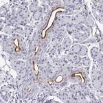 PROL1 Polyclonal Antibody