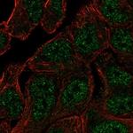 ANKRD65 Polyclonal Antibody