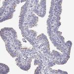 ANKRD65 Antibody in Immunohistochemistry (Paraffin) (IHC (P))
