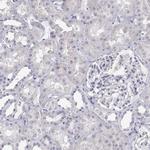 ANKRD65 Antibody in Immunohistochemistry (IHC)