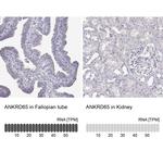 ANKRD65 Antibody