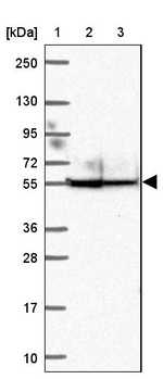 ANKRD65 Antibody in Western Blot (WB)
