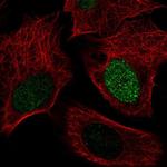 SMIM6 Polyclonal Antibody