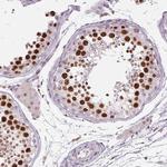 SMIM6 Antibody in Immunohistochemistry (Paraffin) (IHC (P))