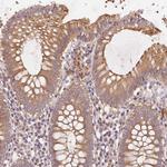 KLHL15 Antibody in Immunohistochemistry (Paraffin) (IHC (P))