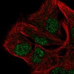 AP5B1 Antibody in Immunocytochemistry (ICC/IF)